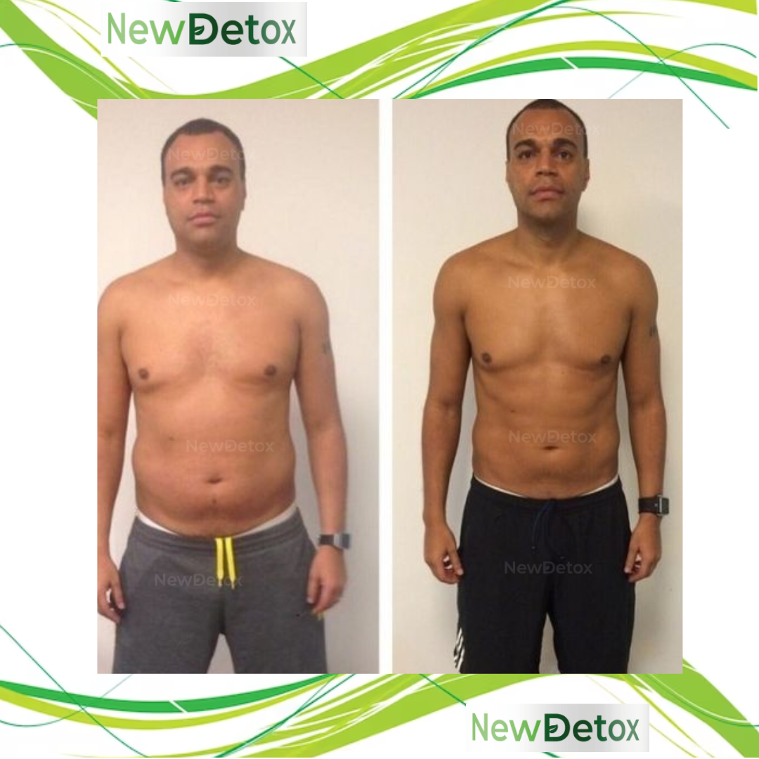 ANTES E DEPOIS(22)