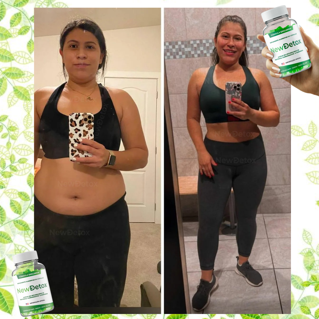 ANTES E DEPOIS(24)