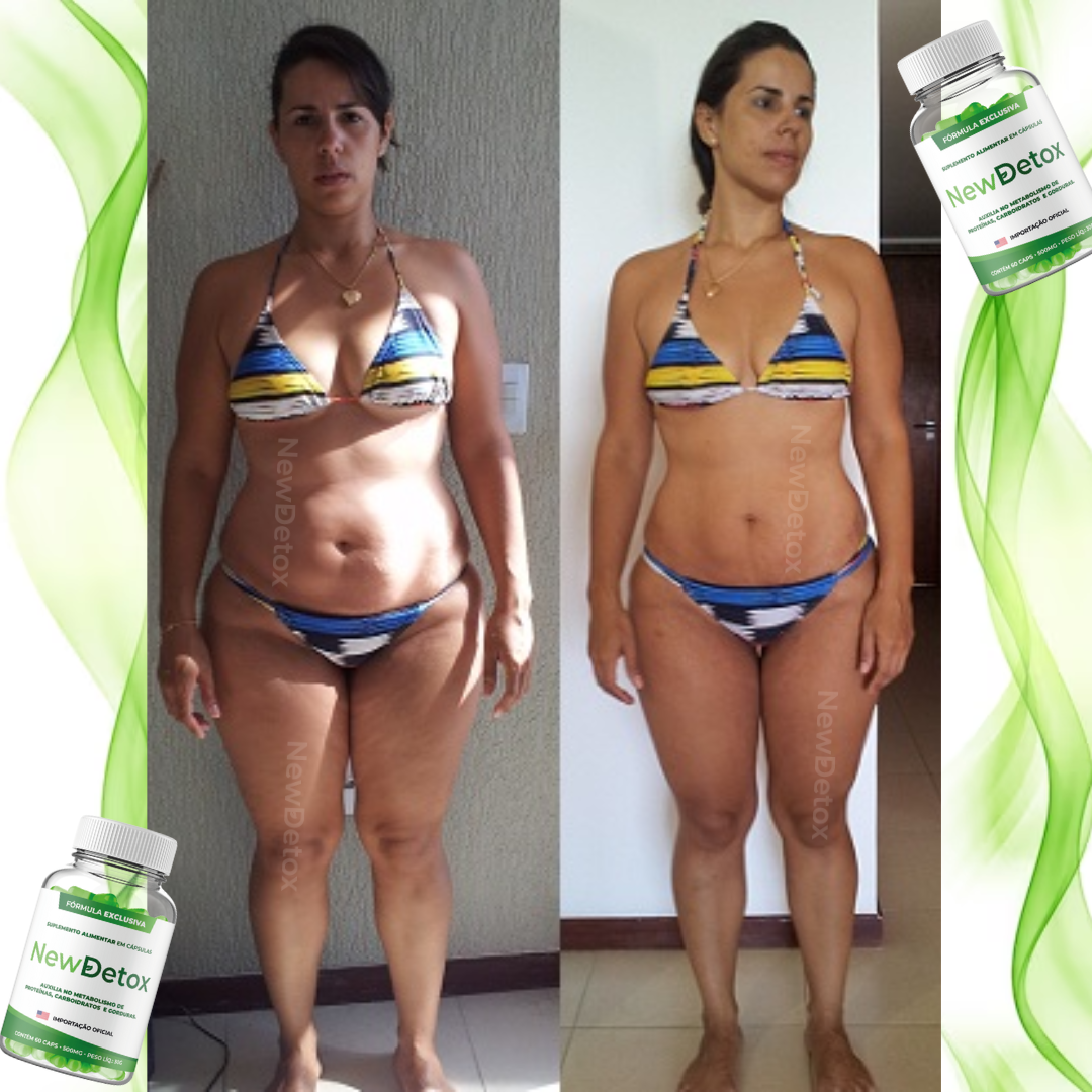 ANTES E DEPOIS(27)