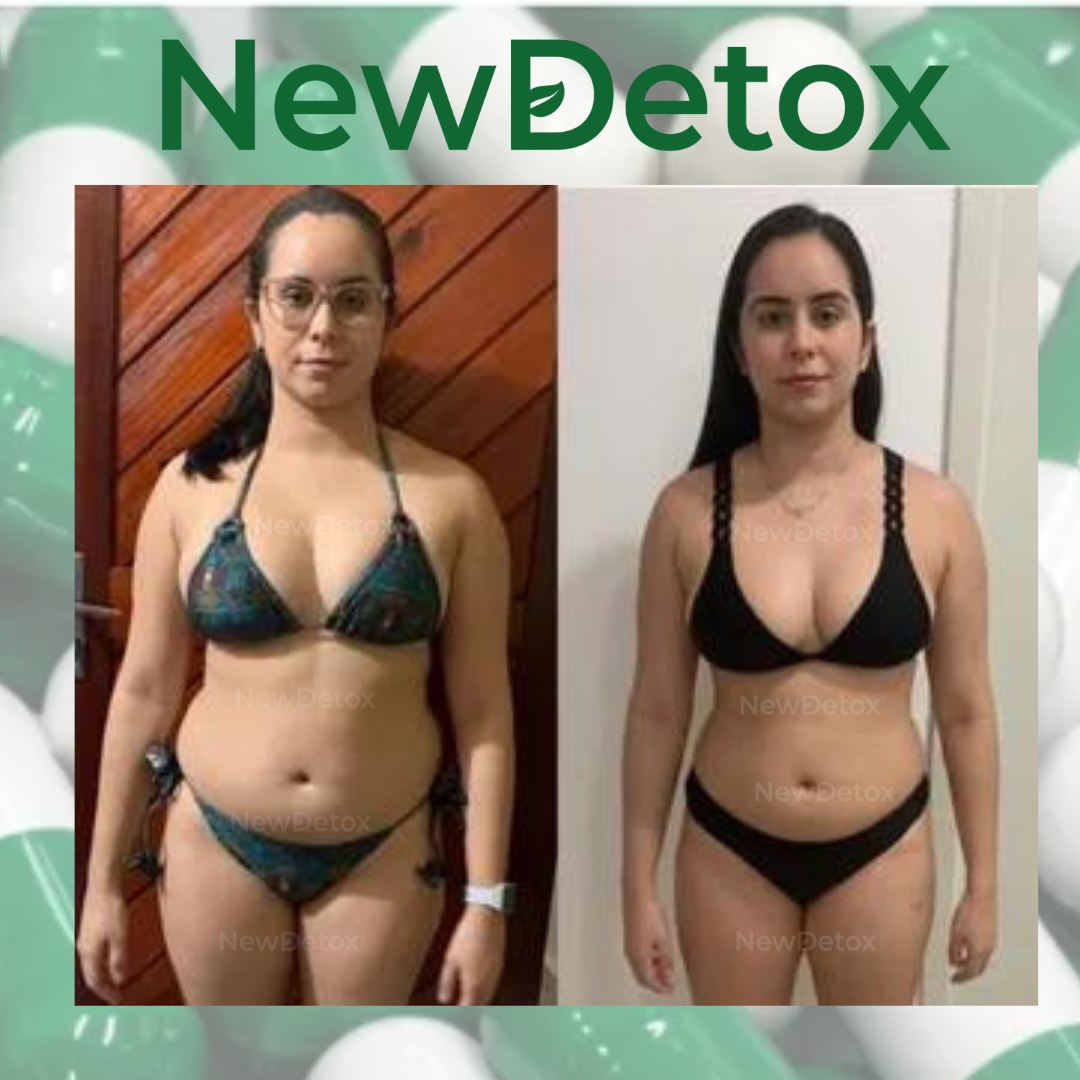 ANTES E DEPOIS_(28)